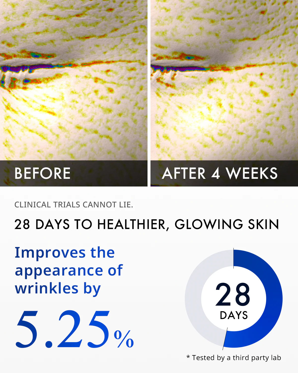Matrixyl® 3000 Collagen Serum 30ml