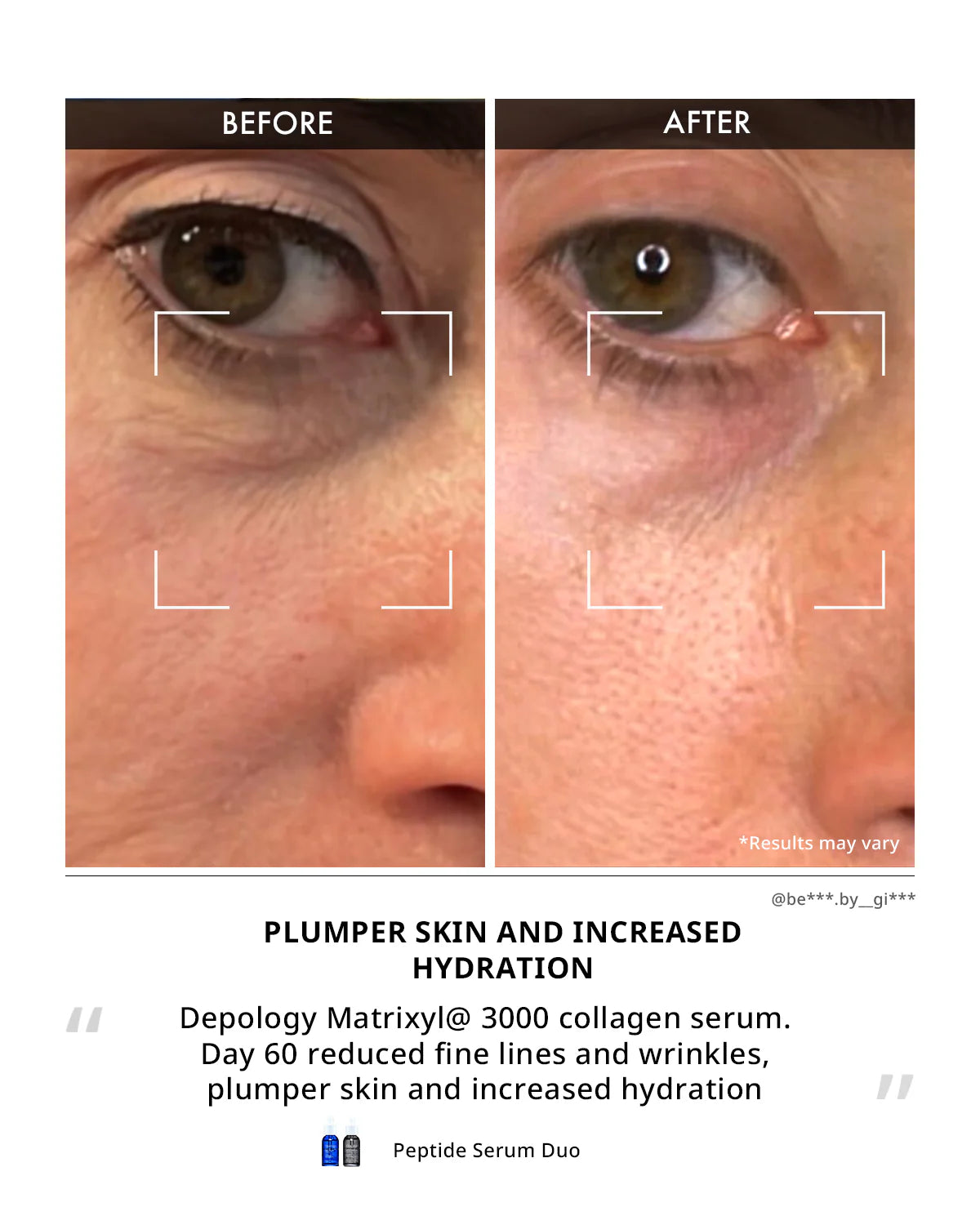 Depology Matrixyl 3000 Collagen Serum 30ml peptide serum designed to reduce the appearance of fine lines and enhance skin elasticity