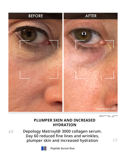Depology Matrixyl 3000 Collagen Serum 30ml peptide serum designed to reduce the appearance of fine lines and enhance skin elasticity