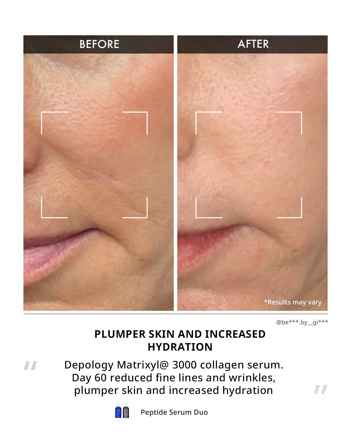 Depology Matrixyl 3000 Collagen Serum 30ml for visibly smoother firmer skin with improved texture and elasticity