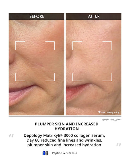 Depology Matrixyl 3000 Collagen Serum 30ml for visibly smoother firmer skin with improved texture and elasticity