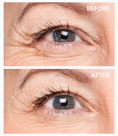 Depology Deepcare Plus Serum Infused Micro Dart Patches before and after on skin showing reduction in wrinkles and smoother surface